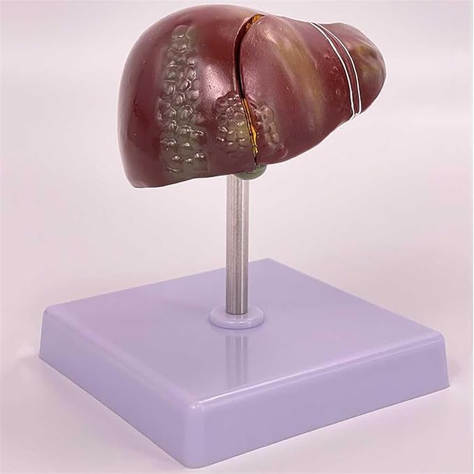 BuTkus Liver Pathology Educational ModelLife Size Human Liver Model with 2 Detachable Parts for Teaching Demonstration and Explanation