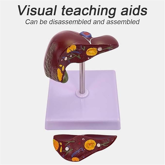 BuTkus Liver Pathology Educational ModelLife Size Human Liver Model with 2 Detachable Parts for Teaching Demonstration and Explanation