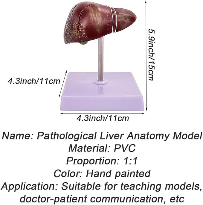 BuTkus Liver Pathology Educational ModelLife Size Human Liver Model with 2 Detachable Parts for Teaching Demonstration and Explanation
