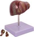 BuTkus Liver Pathology Educational ModelLife Size Human Liver Model with 2 Detachable Parts for Teaching Demonstration and Explanation