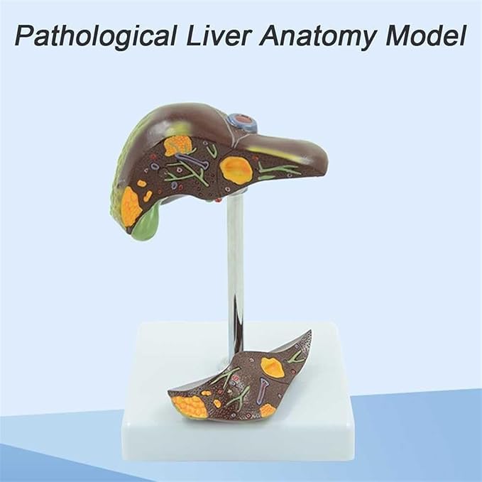 BuTkus Liver Pathology Educational ModelLife Size Human Liver Model with 2 Detachable Parts for Teaching Demonstration and Explanation