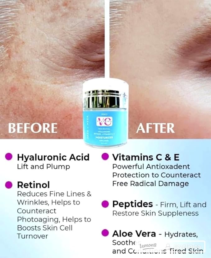 Hyaluronic Acid Moisturizer with Retinol Vit CE Aloe Vera Shea Butter