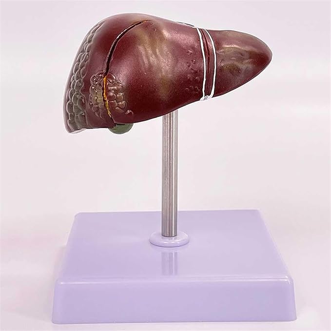 BuTkus Liver Pathology Educational ModelLife Size Human Liver Model with 2 Detachable Parts for Teaching Demonstration and Explanation