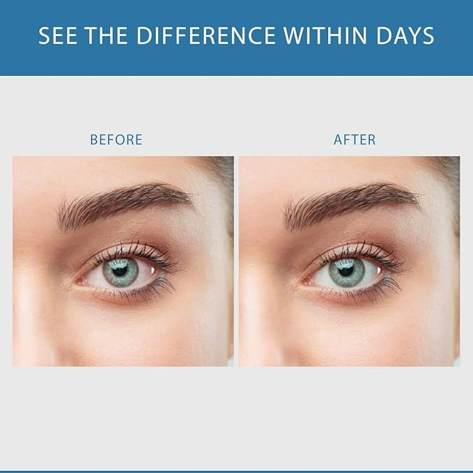 Sclera White Eye Brightening Formula by Success Chemistry - for Beautiful Bright Eyes. Reduce Eye Strain &amp Fatigue. Non-GMO 60 Veggie CAPS
