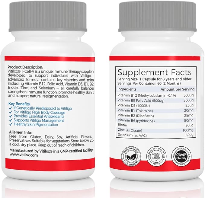 Vitilox Vitiligo T-Cell-V Immune Therapy Capsules – 4 Months Supply