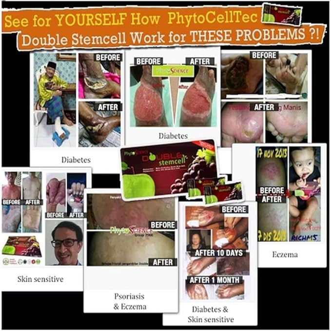 4 Pack PhytoScience Double Stem Cell Apple Grape StemCell Anti Aging Swiss Quality Formula