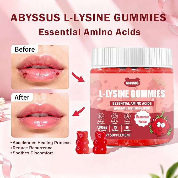 ABYSSUS Lysine Supplement – Sugar Free L-Lysine 1000MG Gummies Lysine for Women with Biotin &amp Folate Skin &amp Immune Support 90 Chewables