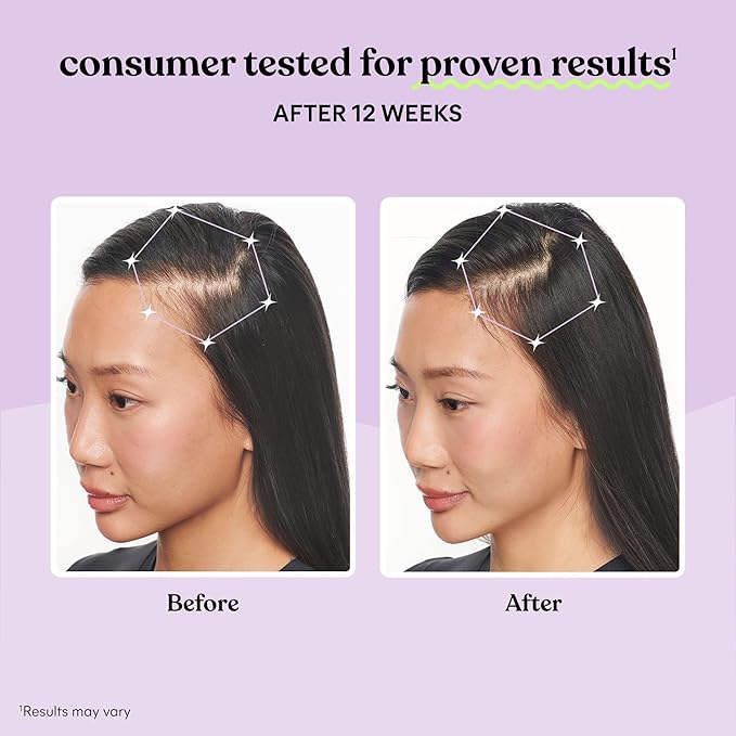 Lemme Grow Hair Growth Supplement for Women Clinically Proven Keratin Complex for Visibly Thicker Hair and Scalp Coverage Reduced Shedding Nourish Thinning Hair - 1 Month Supply
