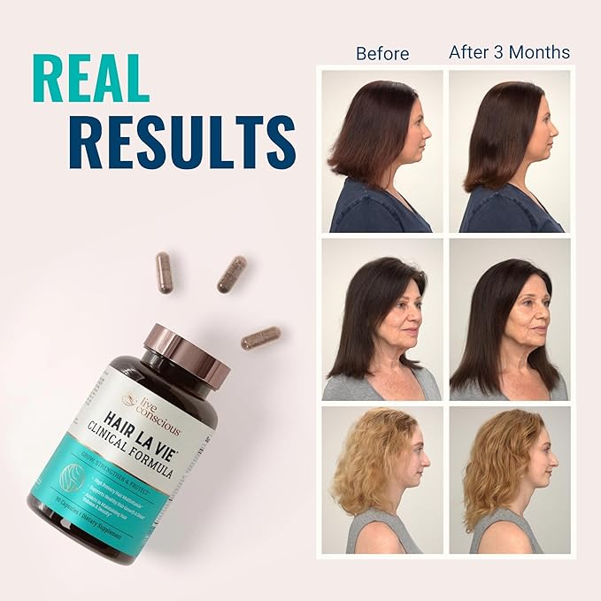 Hair La Vie Live Conscious Clinical Formula Hair Growth Vitamins for Women and Men w/Biotin Collagen &amp Saw Palmetto (Pack of 1)