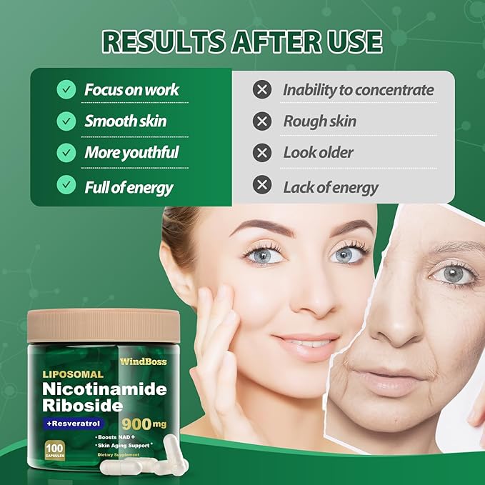 Liposomal NAD+ Supplement with Nicotinamide Riboside &amp Resveratrol NAD Booster for Cellular Energy Anti-Aging &amp Metabolism – NMN Alternative NAD Supplement for Men &amp Women – 2pcs