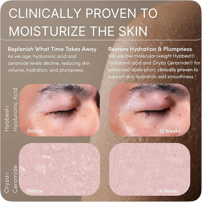 GLOW Anti Aging Supplement - Hyabest® Hyaluronic Acid Phytoceramides 5000 mcg Biotin Vitamin A C E Zinc - Hair Skin Nails Vitamins for Women &amp Men - Wrinkles &amp Skin Hydration - 60 Capsul