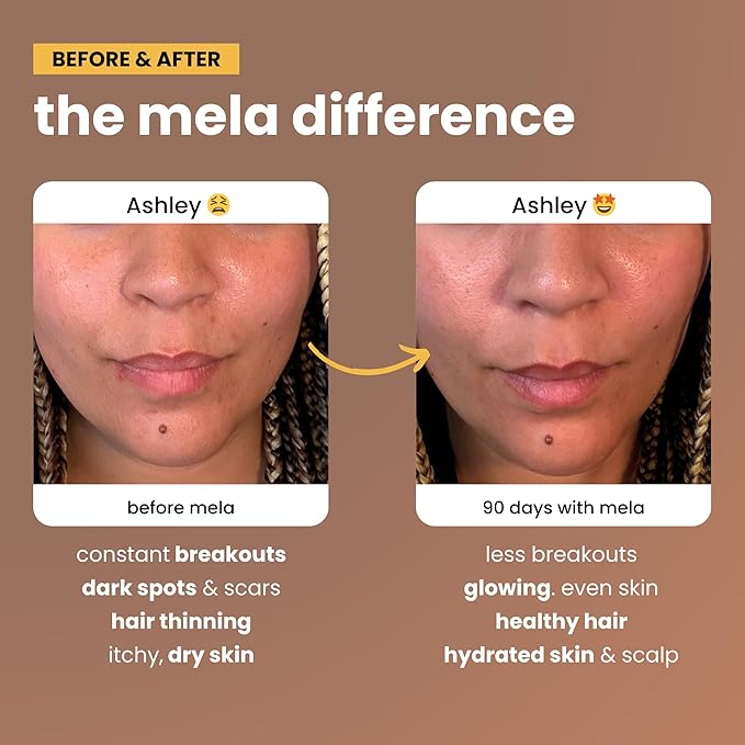 Mela Daily Glow for Healthy Melanin-Rich Skin &amp Textured Hair – with Silica Millet Pumpkin Seed Probiotics Hyaluronic Acid &amp Vitamin D3 – Vegan Biotin-Free Gluten &amp Soy-Free – 60 Cou