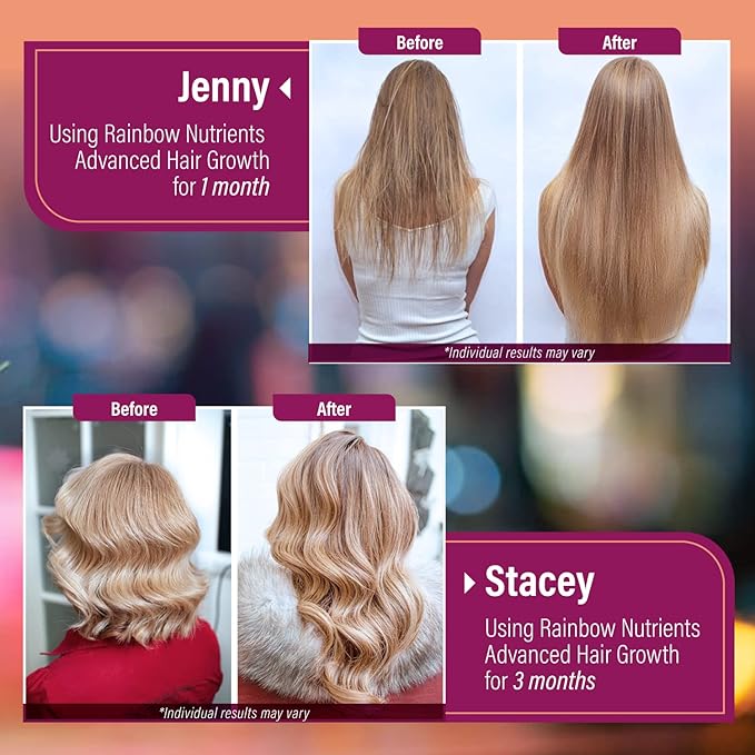 Hair Growth Vitamins for Women | Biotin 10000mcg Collagen Patented OptiMSM® goMCT® Saw Palmetto | Naturally Regrow Stronger &amp Healthier Hair Skin and Nails | Stops Hair Loss | 60 Day Supply
