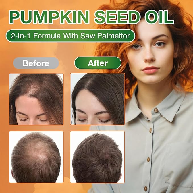 Pumpkin Seed Oil Capsules - Saw Palmetto Pumpkin Seed Oil 300 Softgels Prostate Health Immune and Urinary Tract Support Promotes Hair Growth - Pure Non GMO