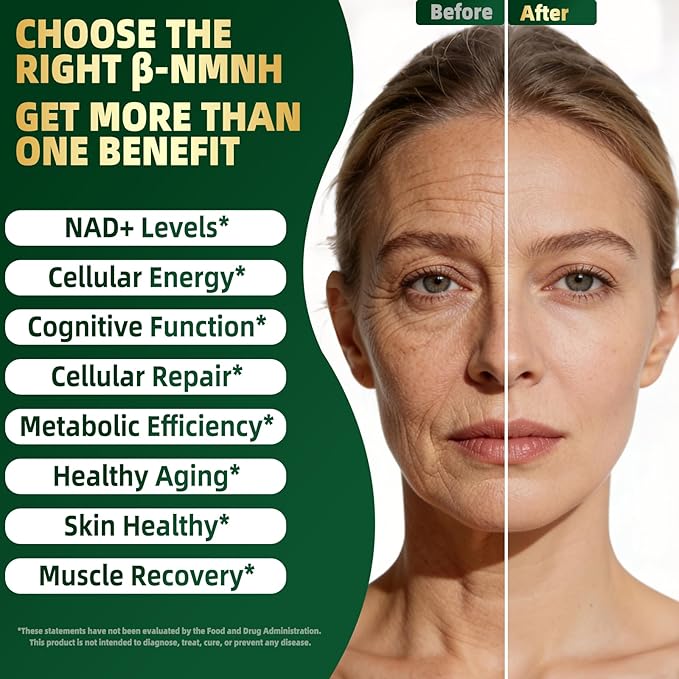 NMNH Supplement 2000mg Liposomal Nicotinamide Mononucleotide Alternative for NAD+ and Healthy Aging - with Resveratrol Urolithin A TMG CoQ10 - 120 Capsules (β-Dihydronicotinamide Mononucleotide)