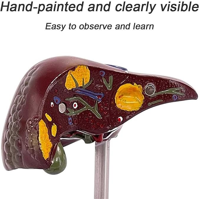 BuTkus Liver Pathology Educational ModelLife Size Human Liver Model with 2 Detachable Parts for Teaching Demonstration and Explanation