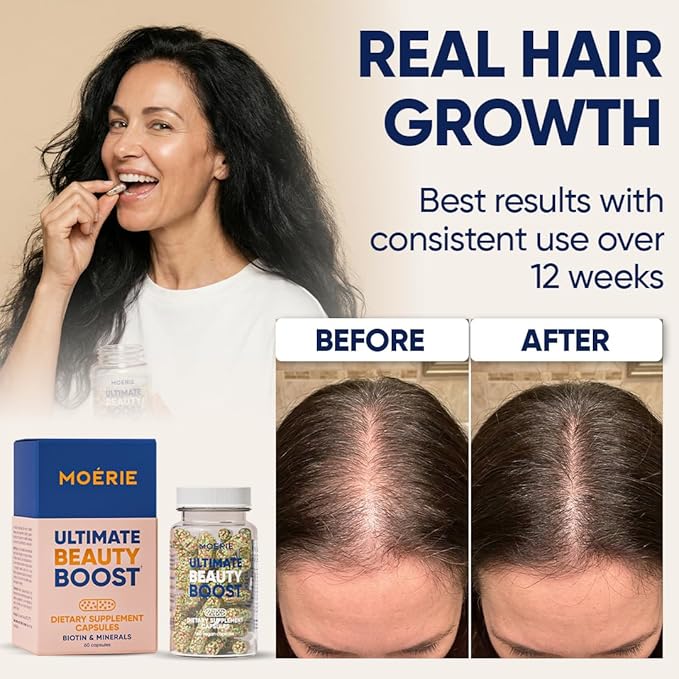 Moerie Hair Growth Supplement for Women &amp Men - Hair Skin and Nails Vitamins With Biotin Q10 &amp Minerals - For Thicker Fuller Hair &amp Hair Loss Treatment - Advanced Beadlet Delivery System