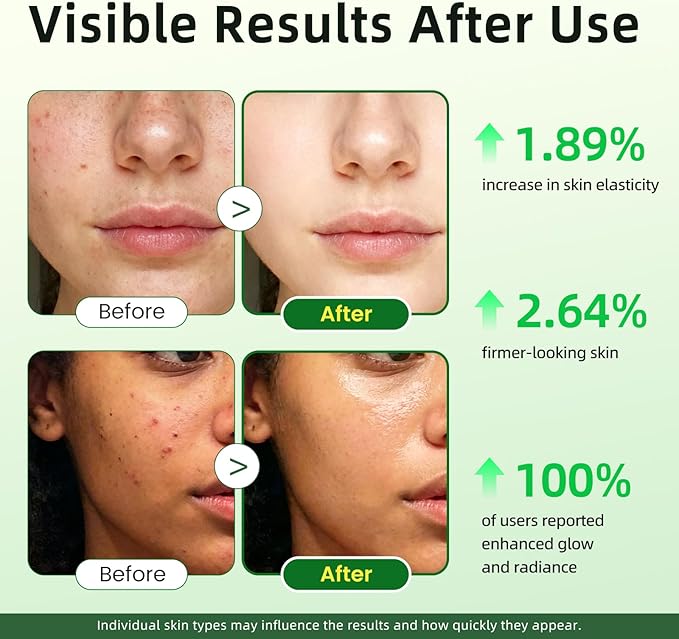 Vitamin C Serum for Face 20% Brightening Face Serum with Sodium Hyaluronate for Dark Spots &amp Fine Lines – Support Collagen &amp Skin Radiance Plus Vit C Caps for Inside-Out Support 1 Fl Oz + 6