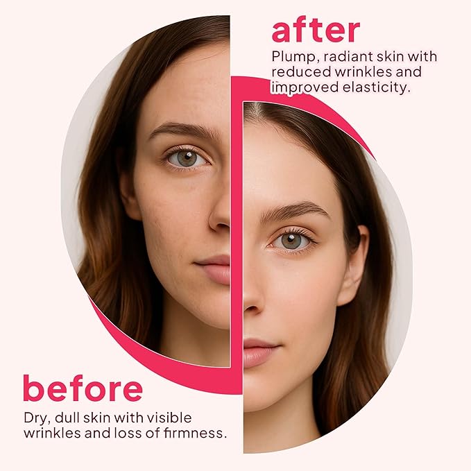 FINE JAPAN Hyaluron &amp Collagen Plus – Liquid Collagen Supplement with Vitamin C Hyaluronic Acid Pearl Coix Supports Skin Hydration Elasticity Hair &amp Nail Health – Made in Japan 17 fl oz