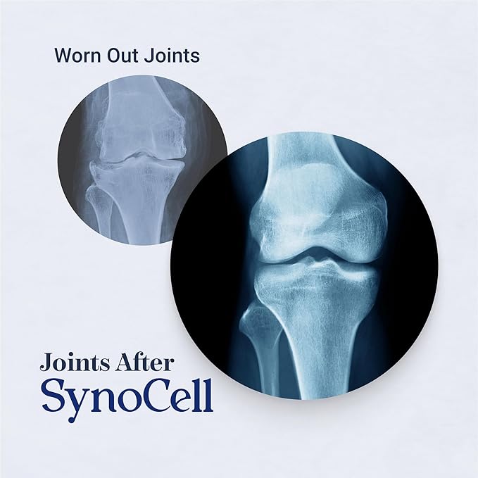 Glucosamine Chondroitin Complex Back Neck and Joint Support Supplement with Boswellia Quercetin &amp MSM - Renew Your Joints from the Inside Out - Move with Freedom and Ease