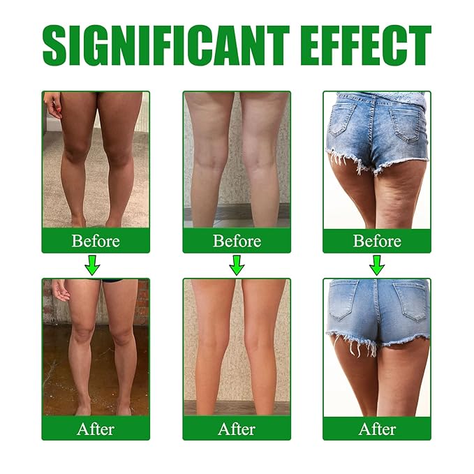 Mugwort Leg Firming Patches - 30 Pcs Hydrolyzed Hyaluronic Acid &amp Glycerin Infused Skin Tightening Strips | Improve Skin Texture &amp Moisture Retention (3)