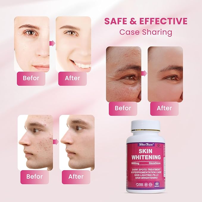 AIHIYO Skin Whitening Pill 8000mg Glutathione Supplement Dark Spots Melasma &amp Acne Scar Remover 60 Tablets
