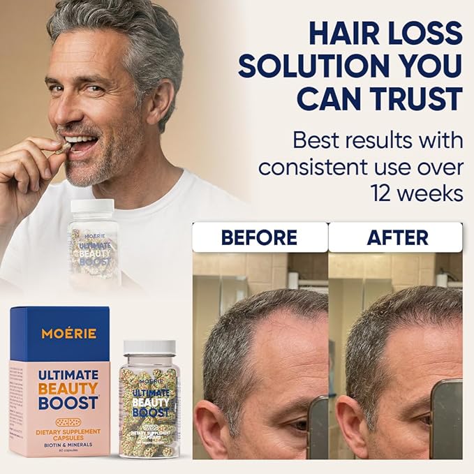 Moerie Hair Growth Supplement for Women &amp Men - Hair Skin and Nails Vitamins With Biotin Q10 &amp Minerals - For Thicker Fuller Hair &amp Hair Loss Treatment - Advanced Beadlet Delivery System