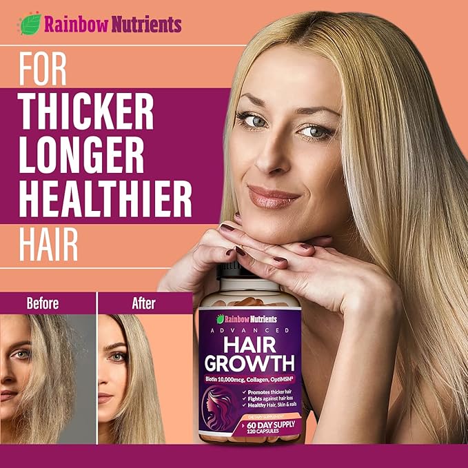 Hair Growth Vitamins for Women | Biotin 10000mcg Collagen Patented OptiMSM® goMCT® Saw Palmetto | Naturally Regrow Stronger &amp Healthier Hair Skin and Nails | Stops Hair Loss | 60 Day Supply