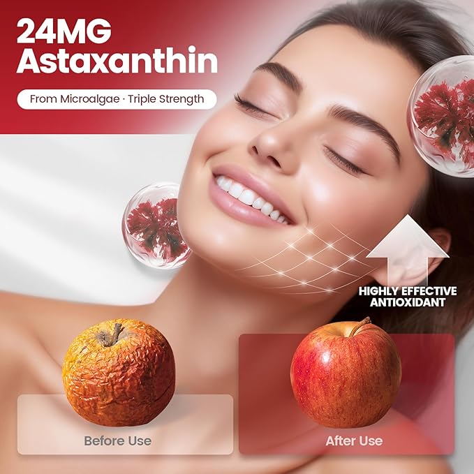 10 in 1 Astaxanthin Supplements 24mg 12 Month Supply Astaxantina Antioxidant from Haematococcus Pluvialis Contains Lycopene Grape Seed Vitamin E &amp More Supports Eye Joints Skin Health 3 B