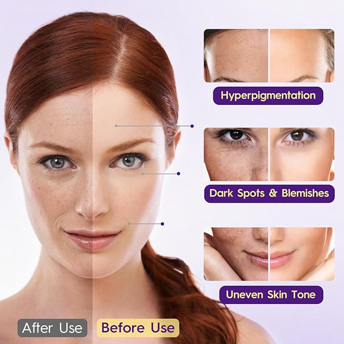 Glutathione Supplement – Skin Brightening Formula with Vitamin C Niacinamide Licorice Extract Collagen &amp Hyaluronic Acid – for Skin Brightness Radiance &amp Hydration – 180 Tablets