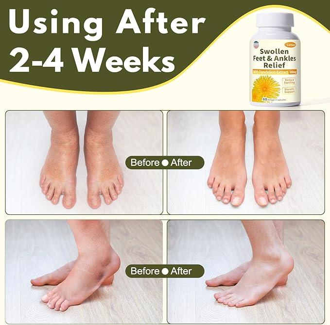 Lunza Swollen Feet and Ankles Relief with 260mg Dandelion Edema Relief for Legs Feet &amp Ankles Water Retention Fast-Acting Formula Natural Ingredients 60 Vegan Capsules
