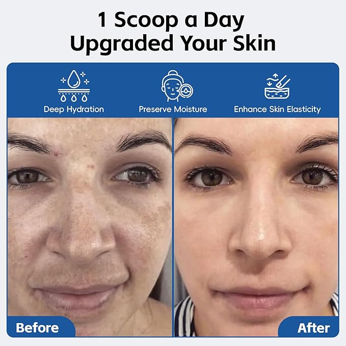 Hyaluronic Acid Powder with Collagen Peptides – DIY Hydrating Serum &amp Skincare Ingredient Clean Formula Gluten-Free No Preservatives – 100g / 3.52oz