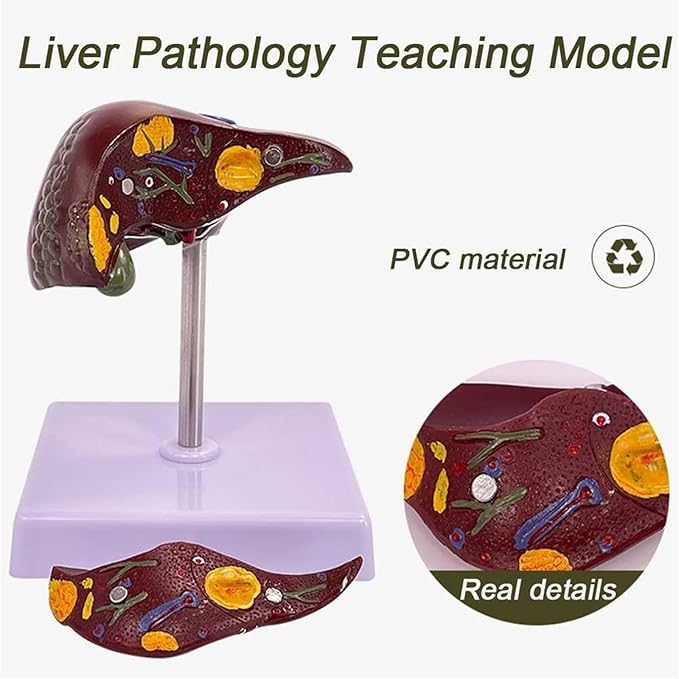 BuTkus Liver Pathology Educational ModelLife Size Human Liver Model with 2 Detachable Parts for Teaching Demonstration and Explanation