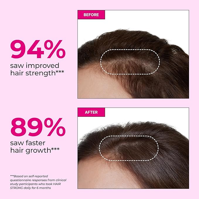 HUM Hair Strong Daily Hair Growth Gummies with Biotin Zinc Vitamin B12 to Support Growth Folic Acid &amp Vitamin B12 Gummy Vitamins for Healthy Hair Support for Women and Men 60 Gummies
