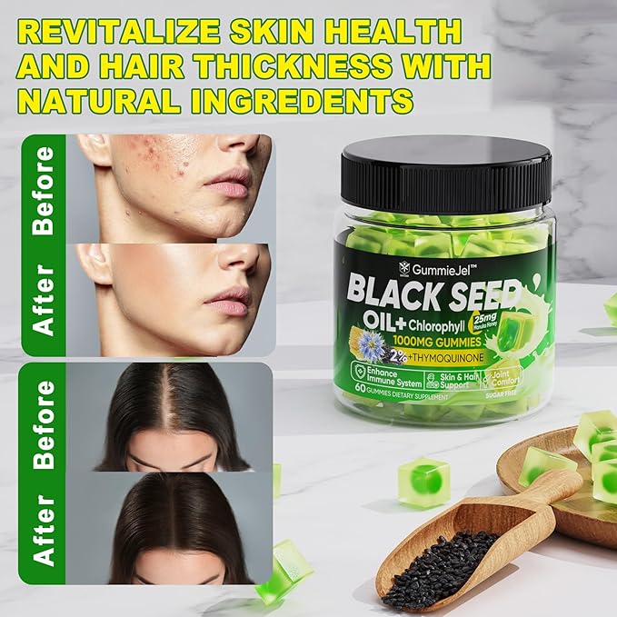 Black Seed Oil Gummies &amp Chlorophyll Biotin 500mcg with Hydrolyzed Collagen Raw Manuka Honey Organic Cold Pressed - Ultimate Absorption for Skin Hair &amp Nails Digestive Overall Health 1