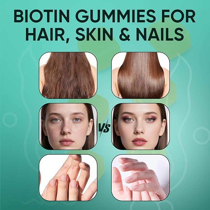 Balmbare Revive Gummies for Hair Loss - Sea Moss Gummies with Vitamin C Vitamin E Aloe Vera Pearl Powder Supports Faster Hair Growth Stronger Nails Extra Strength - 60 Count (1)
