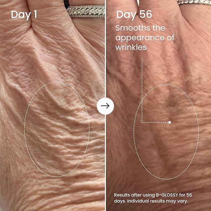 MAËLYS B-GLOSSY Smoothing Body Serum for Women - Hyaluronic Acid &amp Peptide Formula - Helps Reduce the Look of Wrinkles Texture &amp Crepey Skin - Lightweight Fast-Absorbing Anti-Aging Serum (3