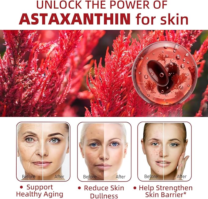 Astaxanthin 24mg Premium Astaxanthin Antioxidant Supplements with MCT Oil Ashwagandha Extract Supports Eye Skin Immune Internal Circulation Microalgae Source Triple Strength - 300 Softgels