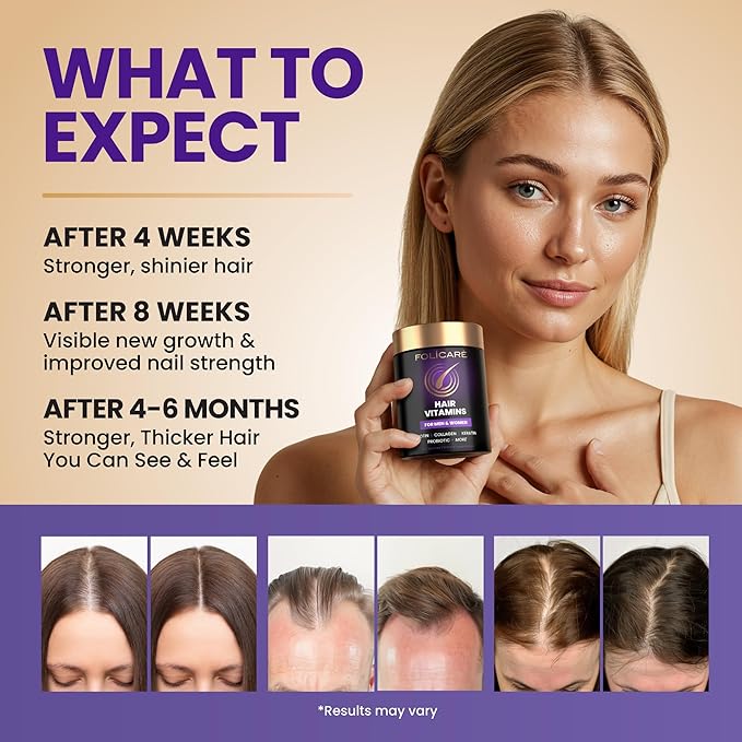 Biotin Hair Growth Supplement with Collagen Keratin and Probiotics – Hair Growth Support Skin &amp Nails Supplement for Men and Women – Supports Thicker Stronger Hair – Made in USA (1 Pack)