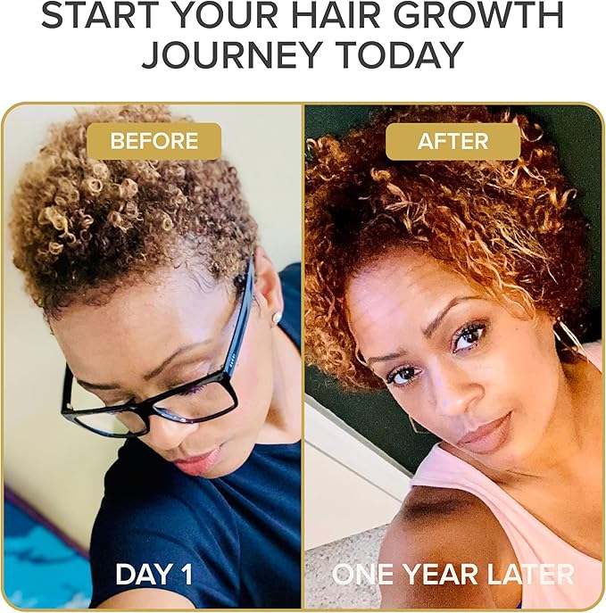 Shedavi Iconic Natural Hair Vitamins for Fast Hair Growth Pure Hair Supplements Formulated with Vitamins to Promote Thicker Stronger Hair - Vegan Hair Care for Hair Loss - (60 Capsules(Pack of 1))