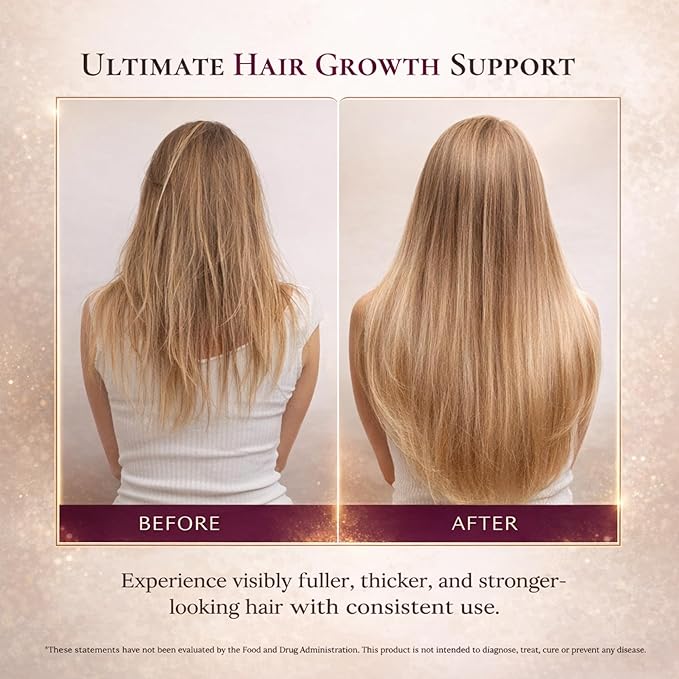 Iron Supplement for Hair Growth – Ferrochel® 100mg Iron Zinc Biotin &amp Vitamin C – Ferritin &amp Hair Loss Support for Women – Vegan – 30 Capsules