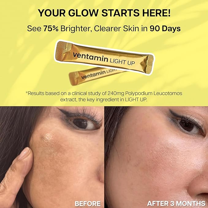 Light Up – Antioxidant Skin-Brightening Supplement with Vitamin C Plant-Based Extracts &amp Hydrating Support – Lemon Green Tea Flavor – for Even Tone Dark Spot Reduction &amp Glow – 30 Sachets