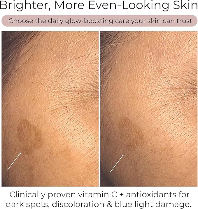 Hush &amp Hush Vitamin C Supplement for Skin Brightening – Clinically Proven Antioxidant-Rich Formula to Reduce Dark Spots Discoloration &amp Blue Light Damage – Vegan Non-GMO Gluten-Free – 60 C