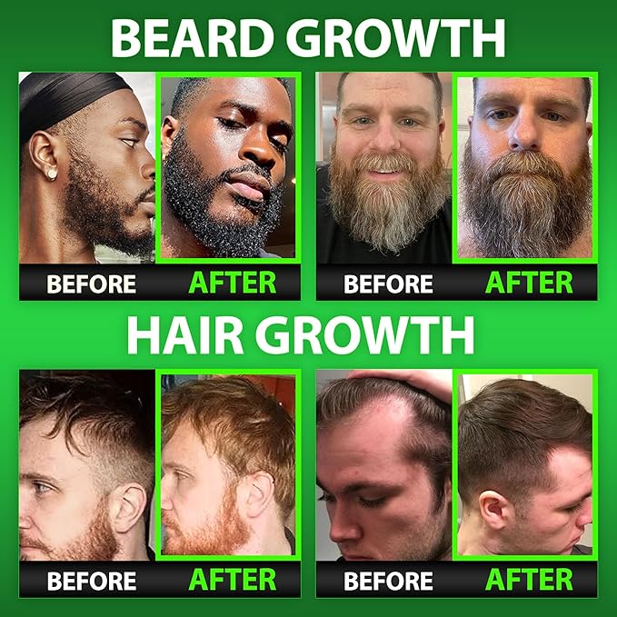 Best Beard Stuff Beard Growth Vitamins - Biotin Gummies for Beard &amp Hair Growth – Maximum Strength 620000mcg Biotin with Collagen MSM Keratin &amp Bamboo Extract