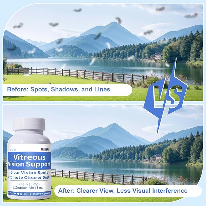Eye Vitamin with Lutein and Zeaxanthin for Vitreous Clarity – Supports Clear Vision – Reduce Squiggly Lines Dry Eyes Screen Fatigue and Degeneration 90 Vegan Capsules