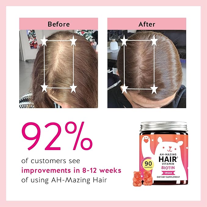 Biotin Gummies for Hair Skin &amp Nails. 5000 mcg High Potency Vegan Vitamins for Faster Hair Growth Stronger Nails &amp Healthy Skin. with Vitamins C &amp E 30 Gummies