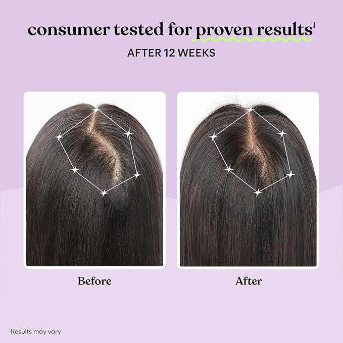 Lemme Grow Hair Growth Supplement for Women Clinically Proven Keratin Complex for Visibly Thicker Hair and Scalp Coverage Reduced Shedding Nourish Thinning Hair - 1 Month Supply
