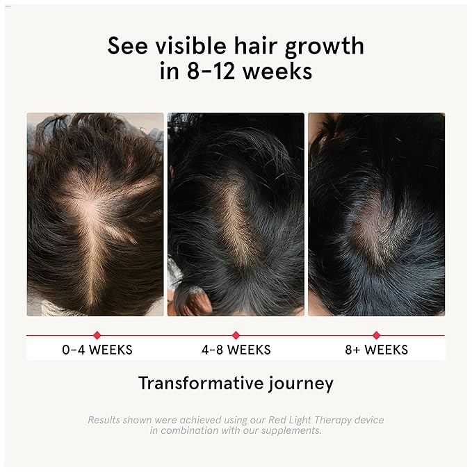 iRestore Hair Growth Supplement - Hair Loss Vitamins for Women and Men - Biotin Multivitamins &amp DHT Blocker to Reduce Hair Thinning - Hair Regrowth Pills - 30 Days Supply 90 Count (Pack of 1)