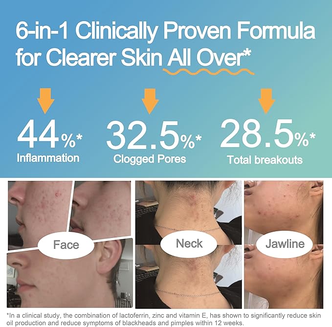 Life-Space Acne Relief + Skin Rebalance Probiotic 6-in-1 Scientific Formula &amp 2 Billion CFU Support Breakout Control &amp Skin Health &amp Gut Health Probiotics for Women &amp Men 30 Vegeta