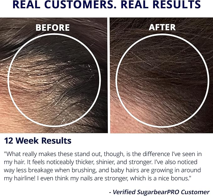 SugarBearPro Hair Vitamin Gummy 1 Month Supply Extra Strength Biotin 6000mcg for Hair Growth Vegan Vitamin B12 MSM Inositol Omega 3 Elderberry Certified Kosher Halal Cruelty-Free